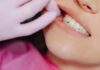 Enlever le tartre des dents avec des astuces de grand-mère Enlever le tartre des dents avec des astuces de grand-mère Marie Lopez