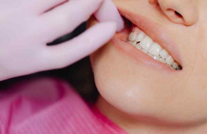 Enlever le tartre des dents avec des astuces de grand-mère Marie Lopez Enlever le tartre des dents avec des astuces de grand-mère Marie Lopez